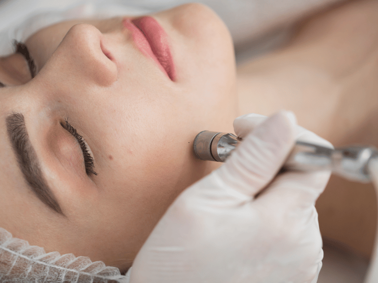 Discover options for Microdermabrasion San Antonio TX